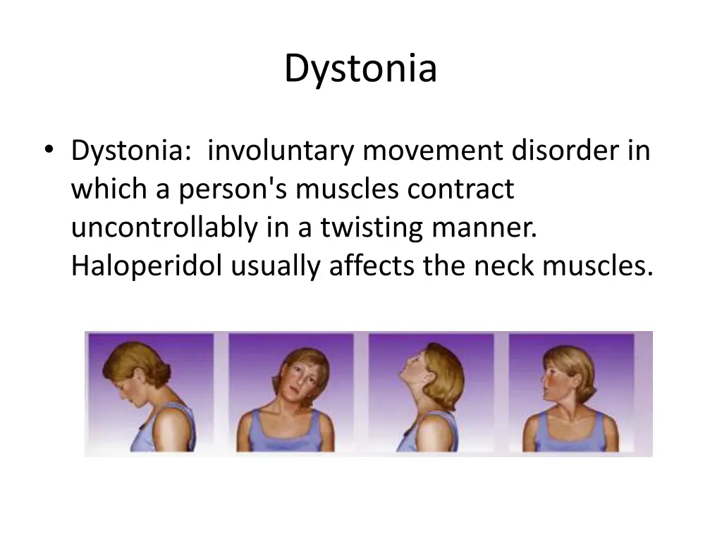 dystonia