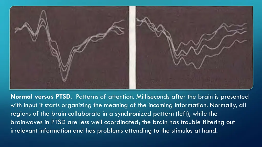 normal versus ptsd patterns of attention