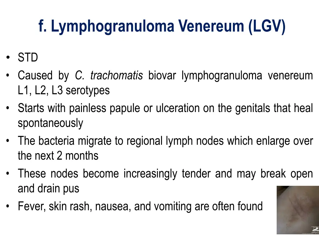 f lymphogranuloma venereum lgv