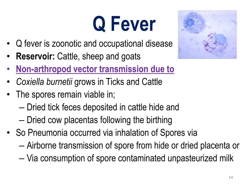 q fever