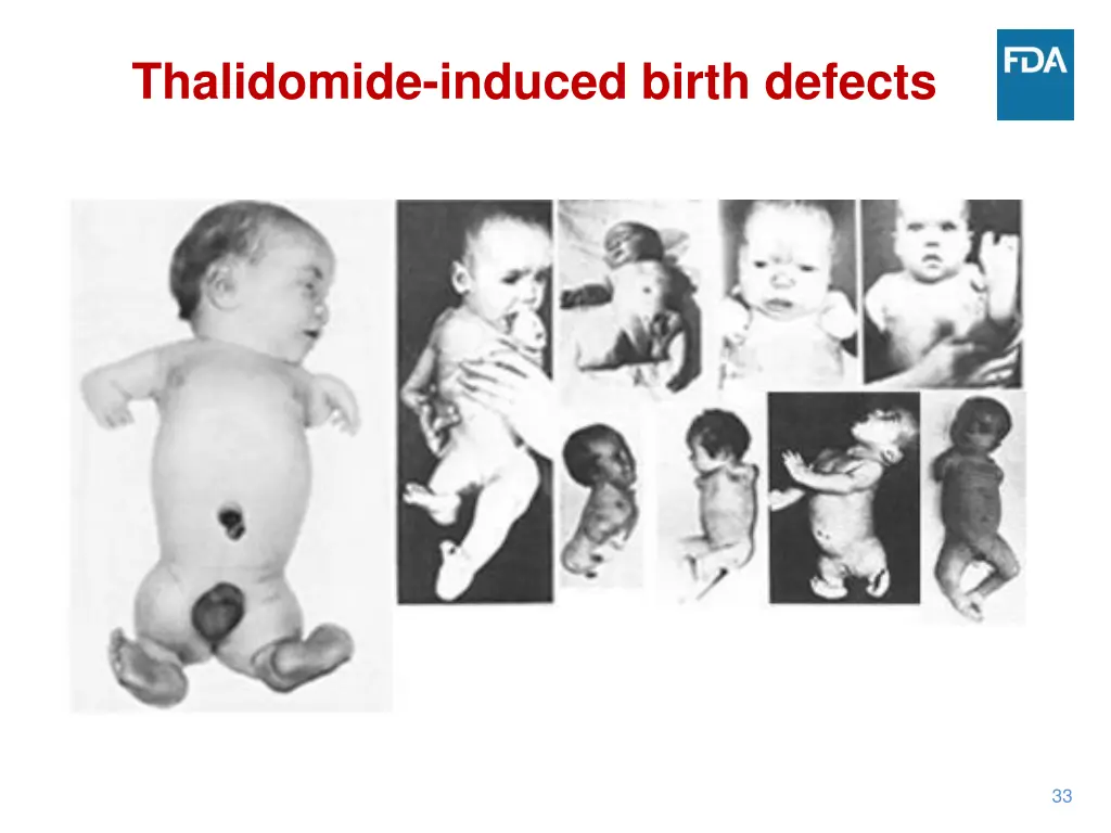 thalidomide induced birth defects