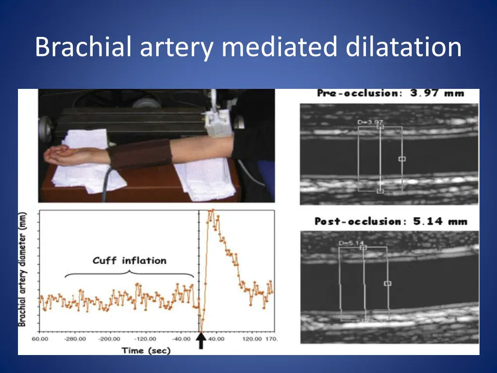 brachial artery mediated dilatation