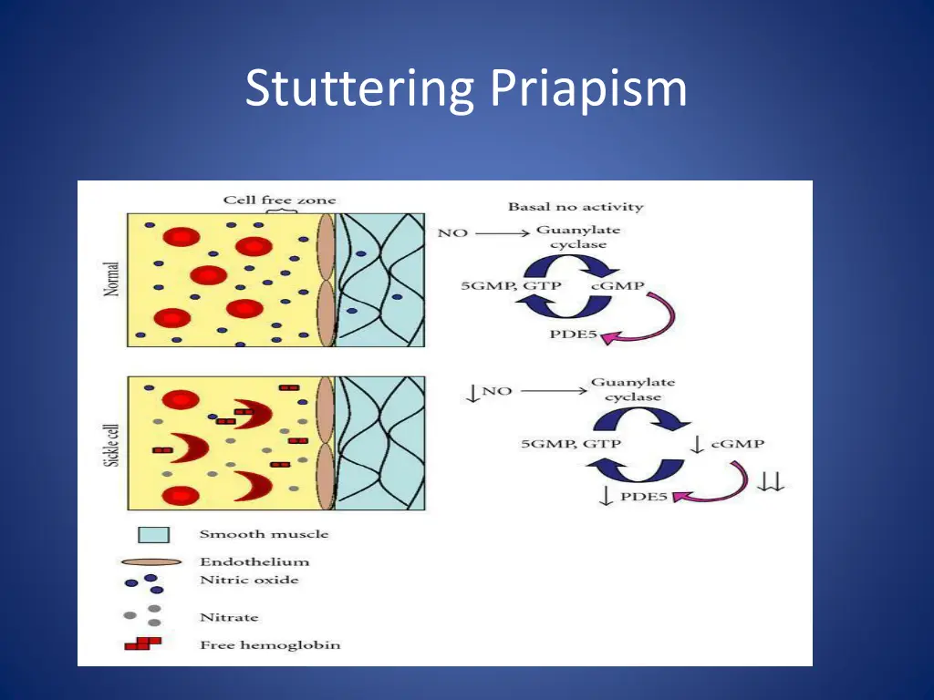 stuttering priapism