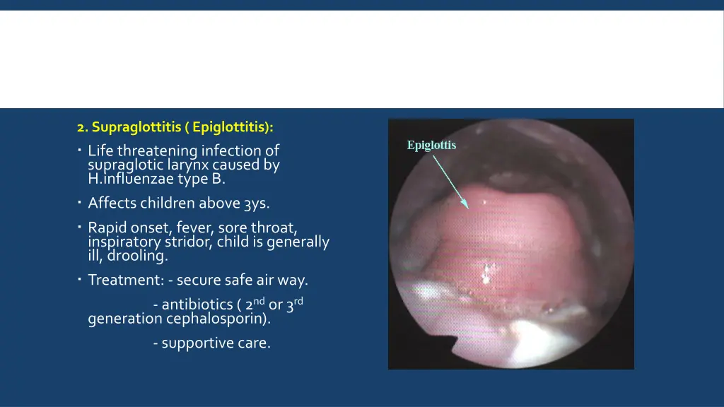 2 supraglottitis epiglottitis life threatening