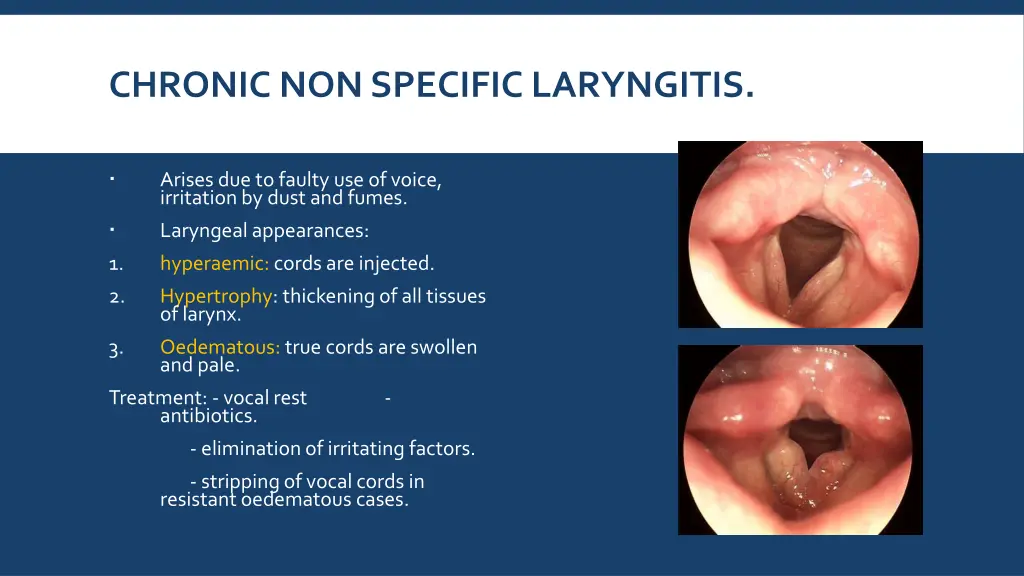 chronic non specific laryngitis