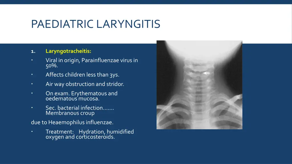 paediatric laryngitis