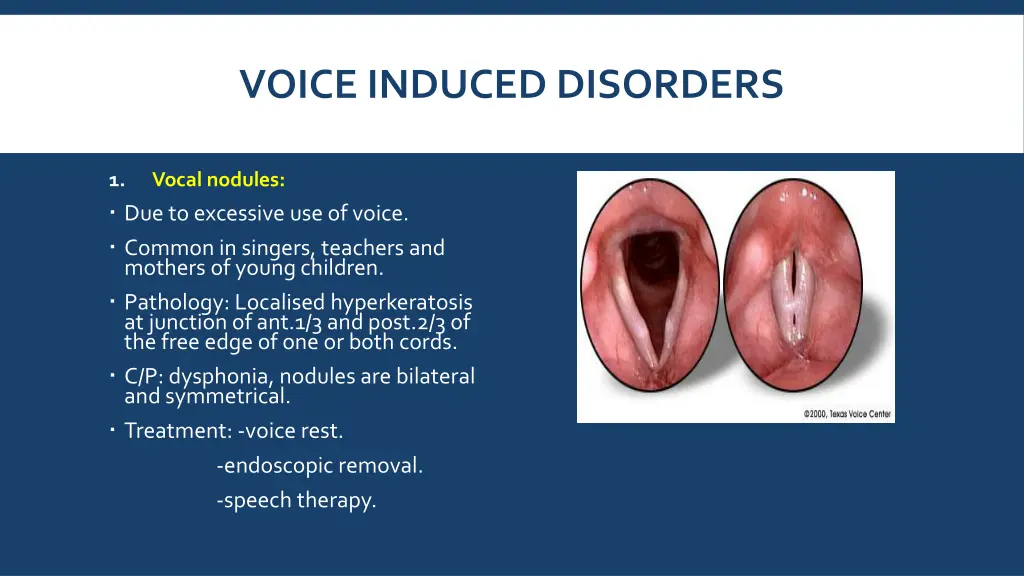 voice induced disorders