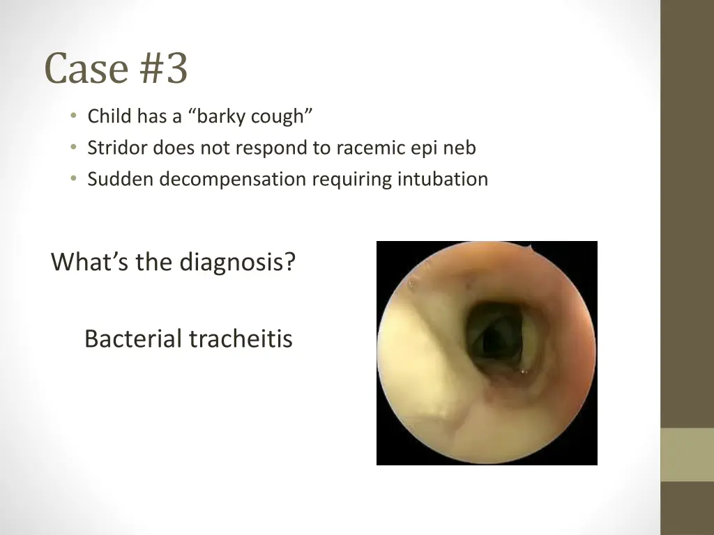 case 3 child has a barky cough stridor does