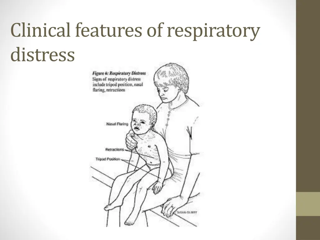 clinical features of respiratory distress