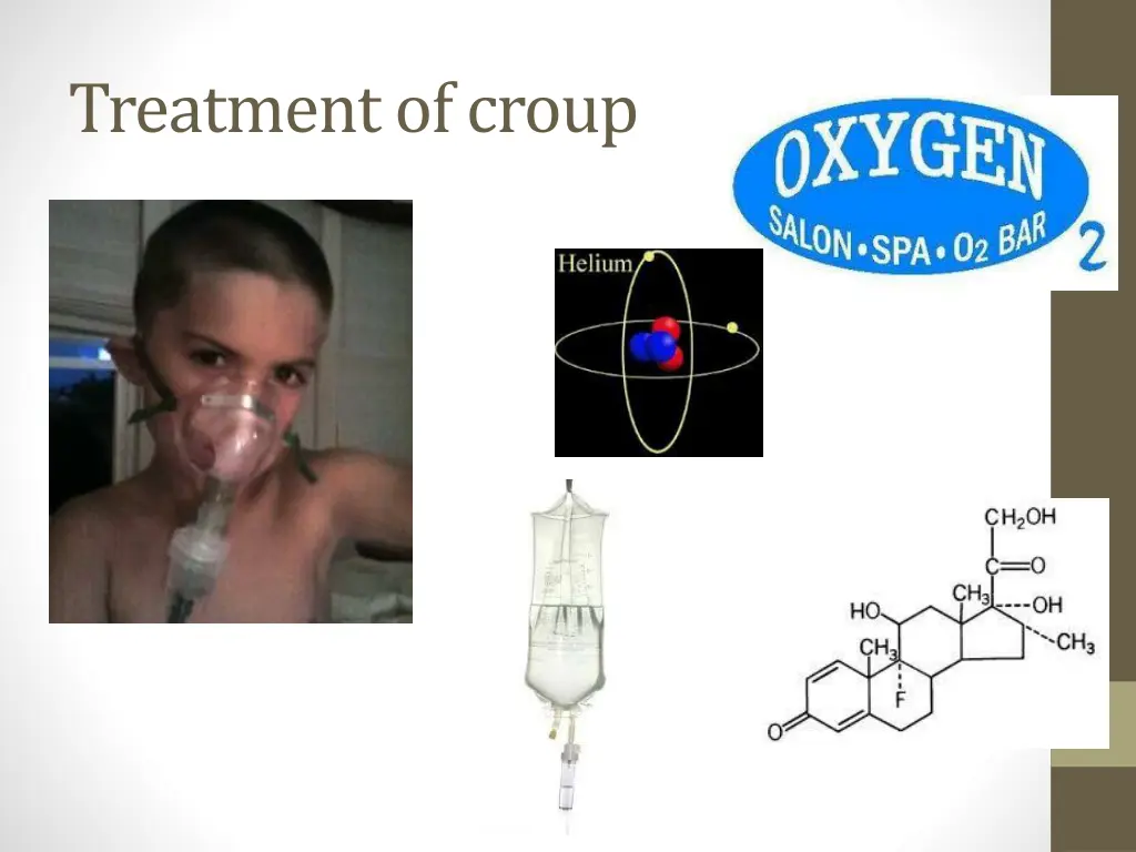 treatment of croup