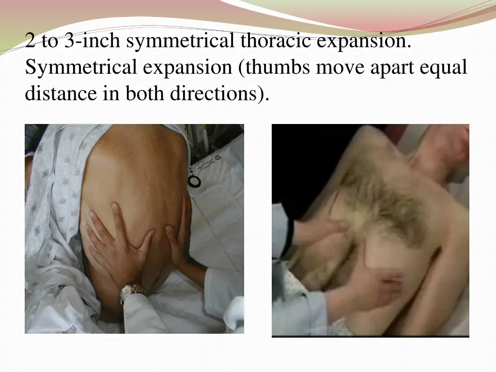 2 to 3 inch symmetrical thoracic expansion