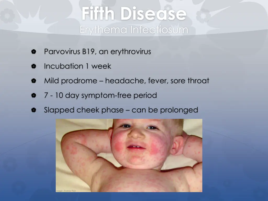 fifth disease erythema infectiosum