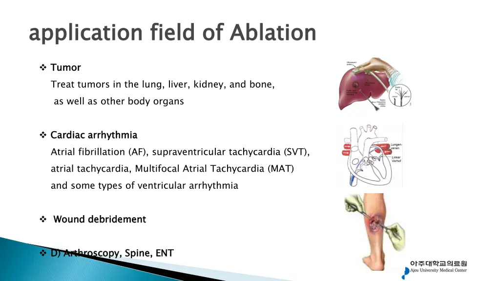 application field of ablation