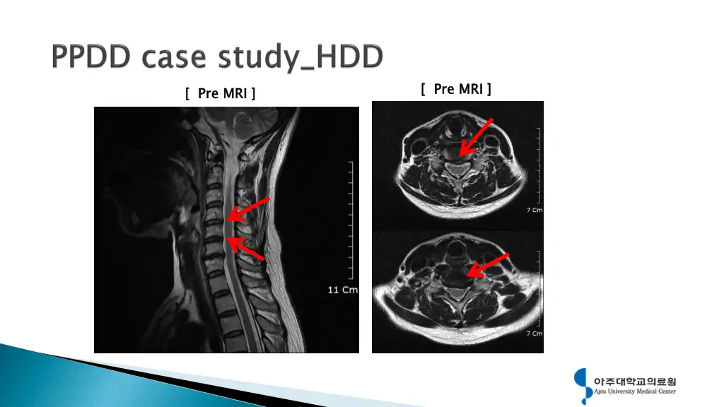 pre mri 3