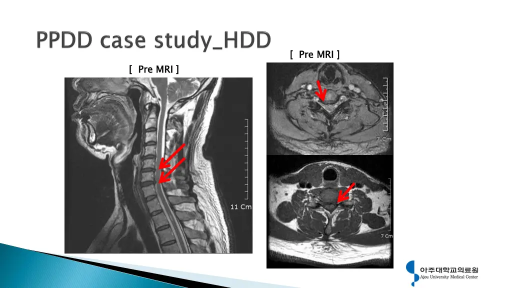 pre mri 4