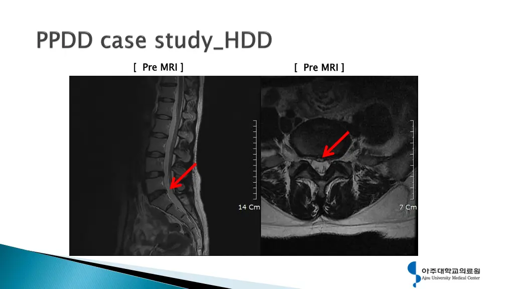 pre mri 5