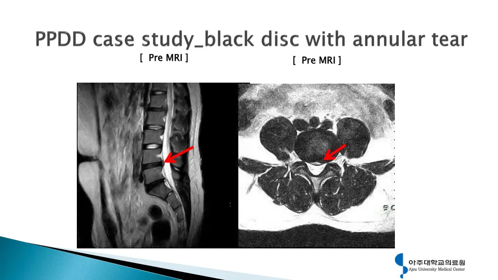 pre mri 6