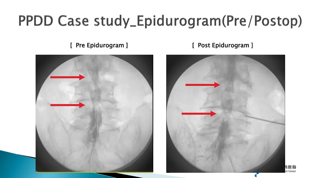 slide17