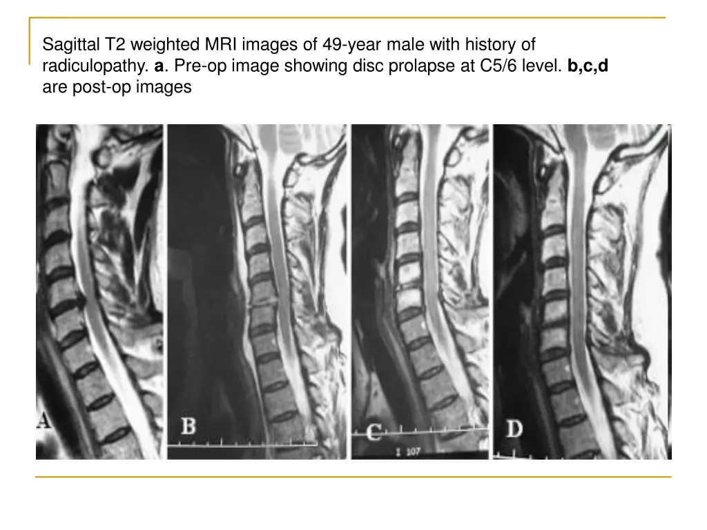 sagittal t2 weighted mri images of 49 year male