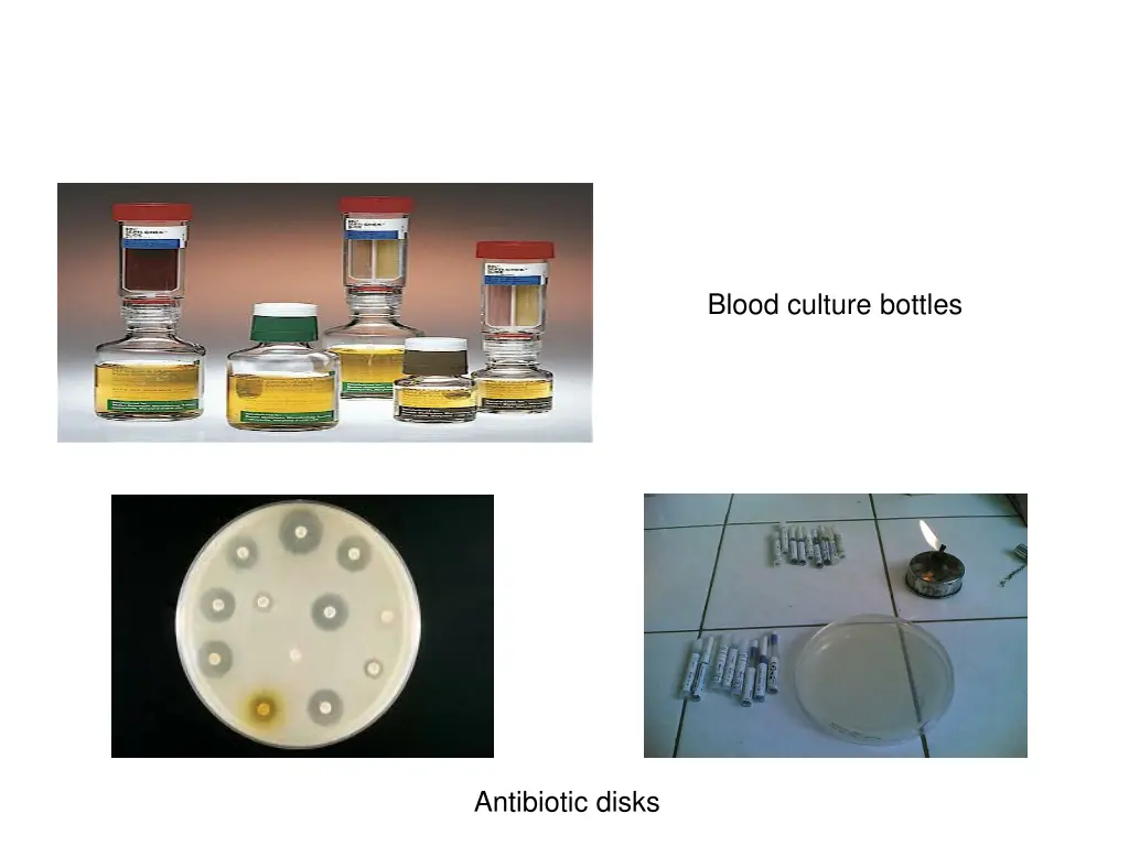 blood culture bottles