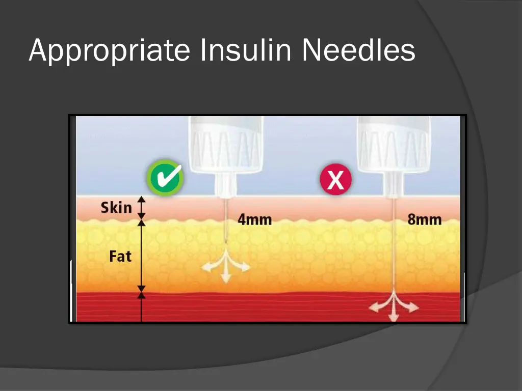 appropriate insulin needles