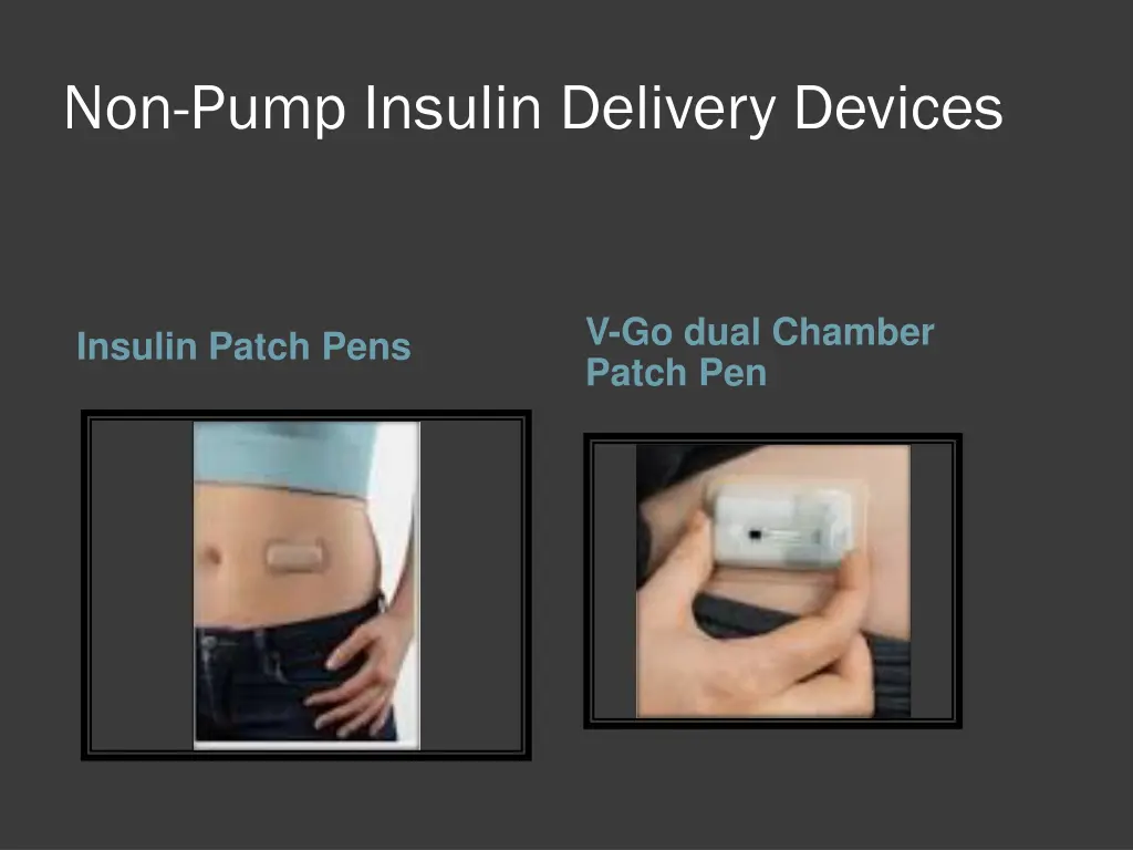 non pump insulin delivery devices