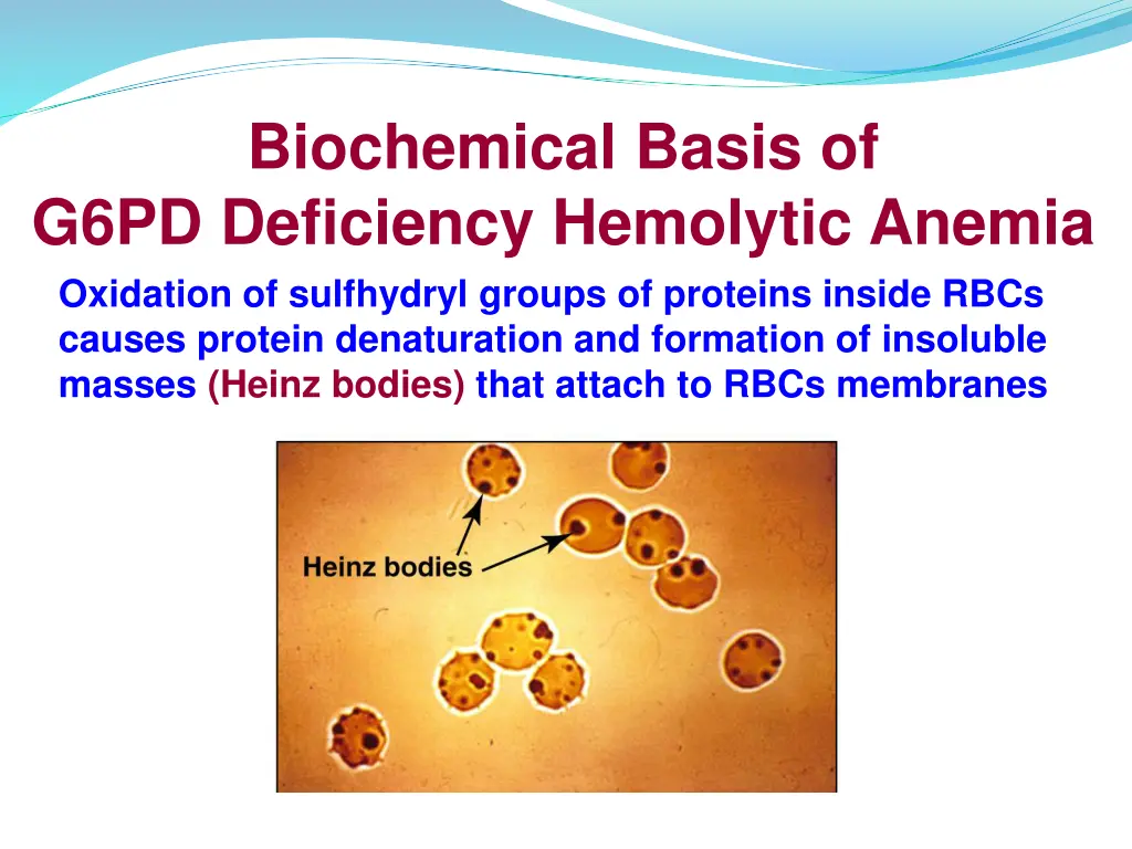 biochemical basis of g6pd deficiency hemolytic 1