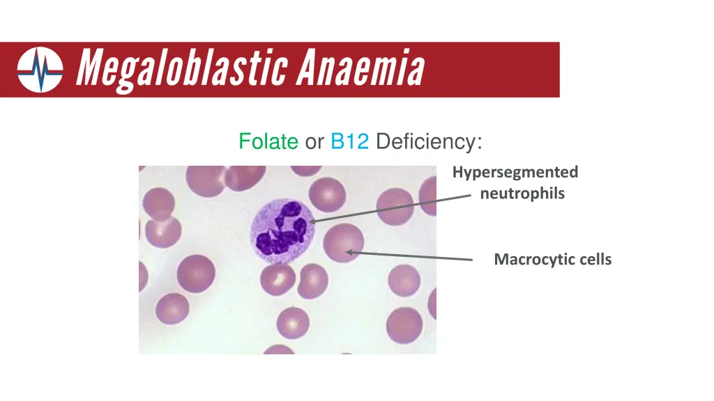 folate or b12 deficiency