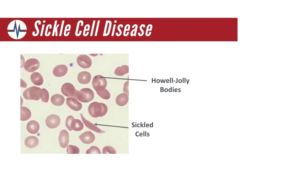 howell jolly bodies