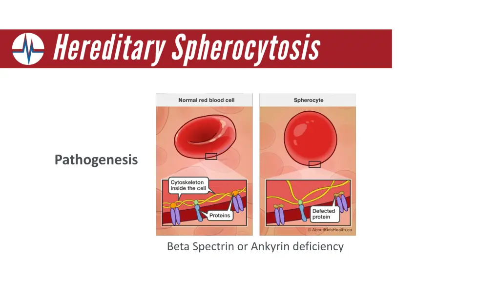 pathogenesis