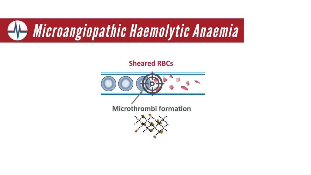 sheared rbcs