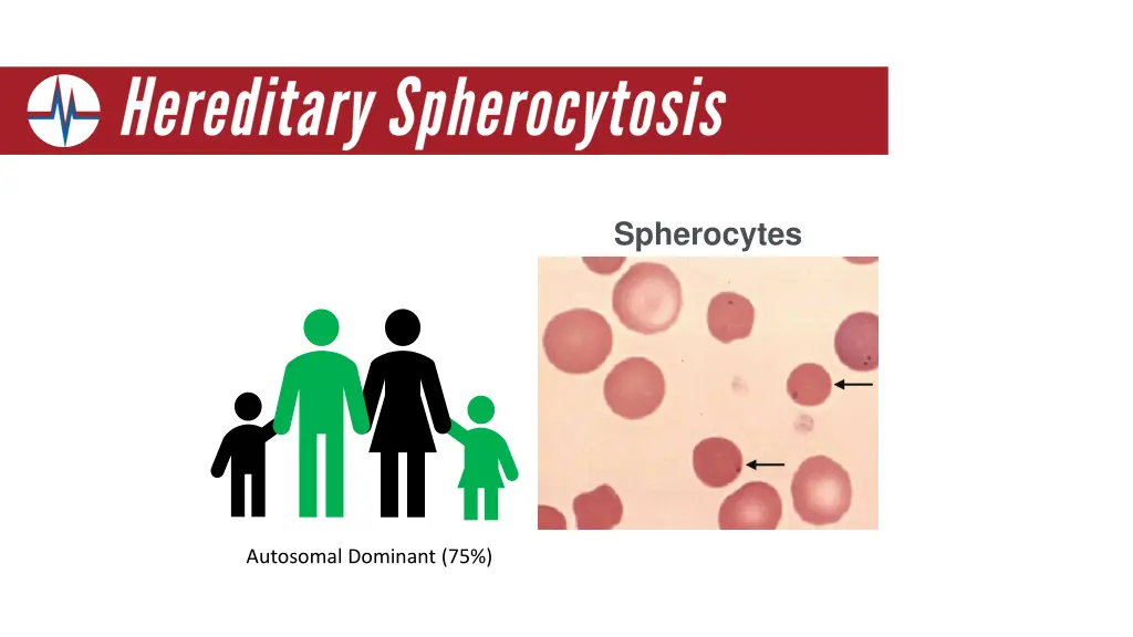 spherocytes