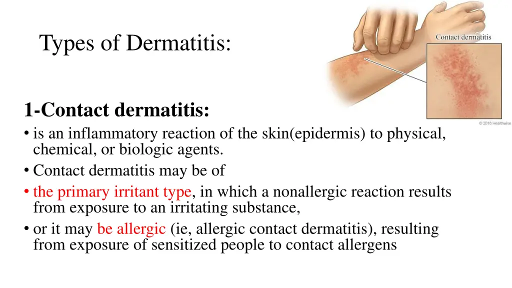 types of dermatitis