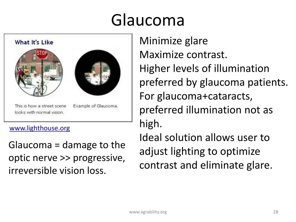 glaucoma minimize glare maximize contrast higher