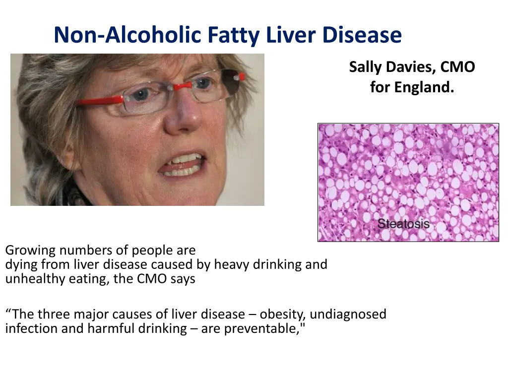 non alcoholic fatty liver disease