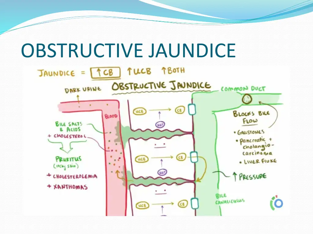 obstructive jaundice