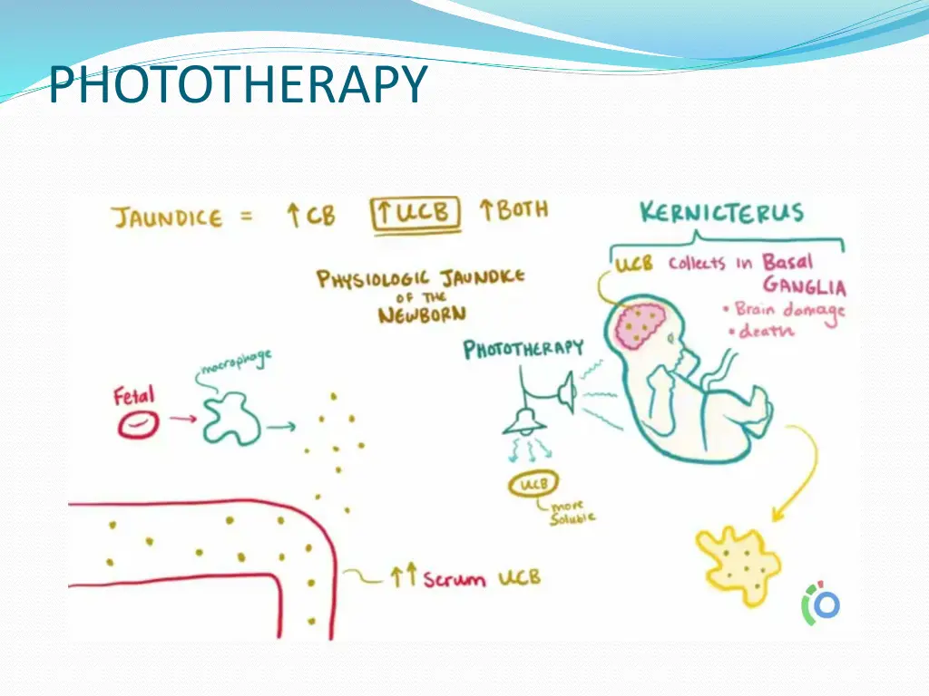 phototherapy