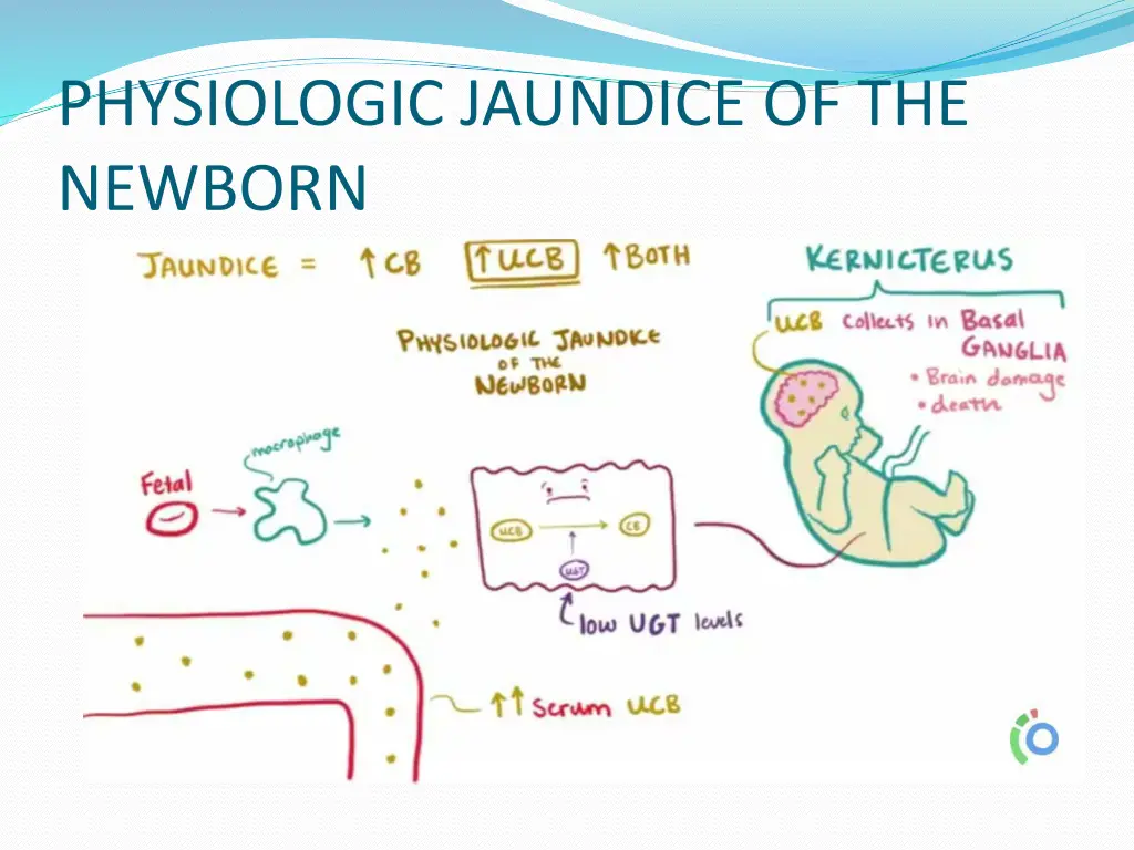 physiologic jaundice of the newborn