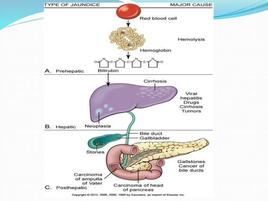 slide26