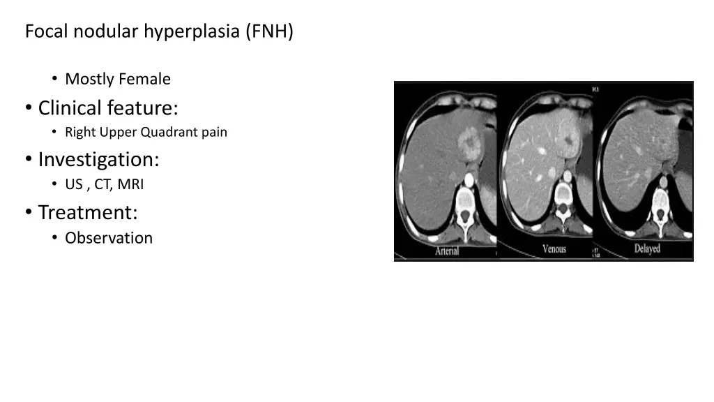 focal nodular hyperplasia fnh