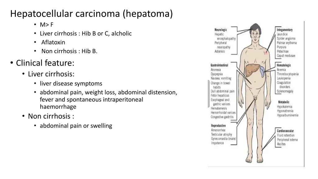 hepatocellular carcinoma hepatoma m f liver