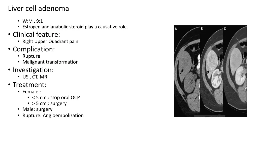 liver cell adenoma