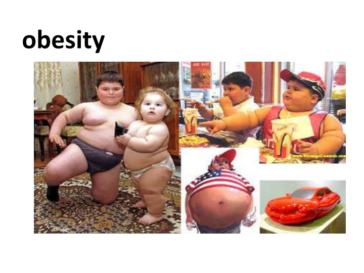 obesity