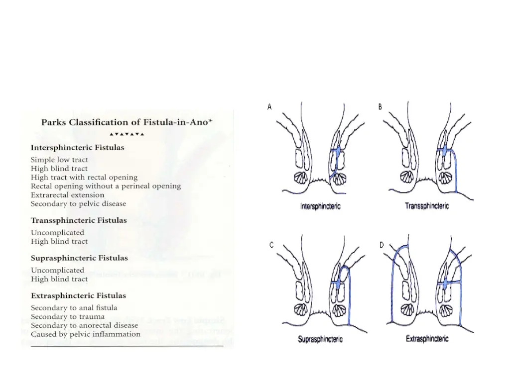 slide16