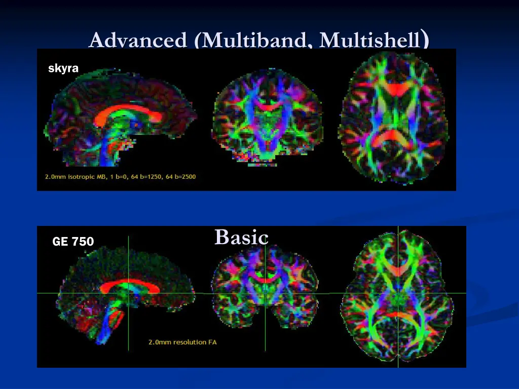 advanced multiband multishell