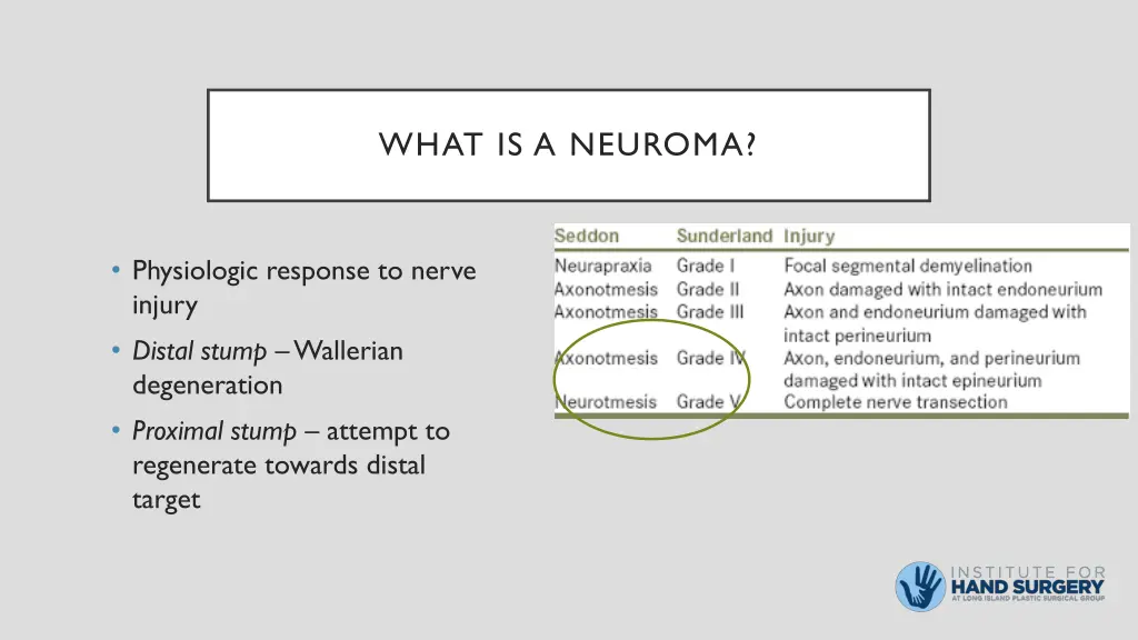 what is a neuroma