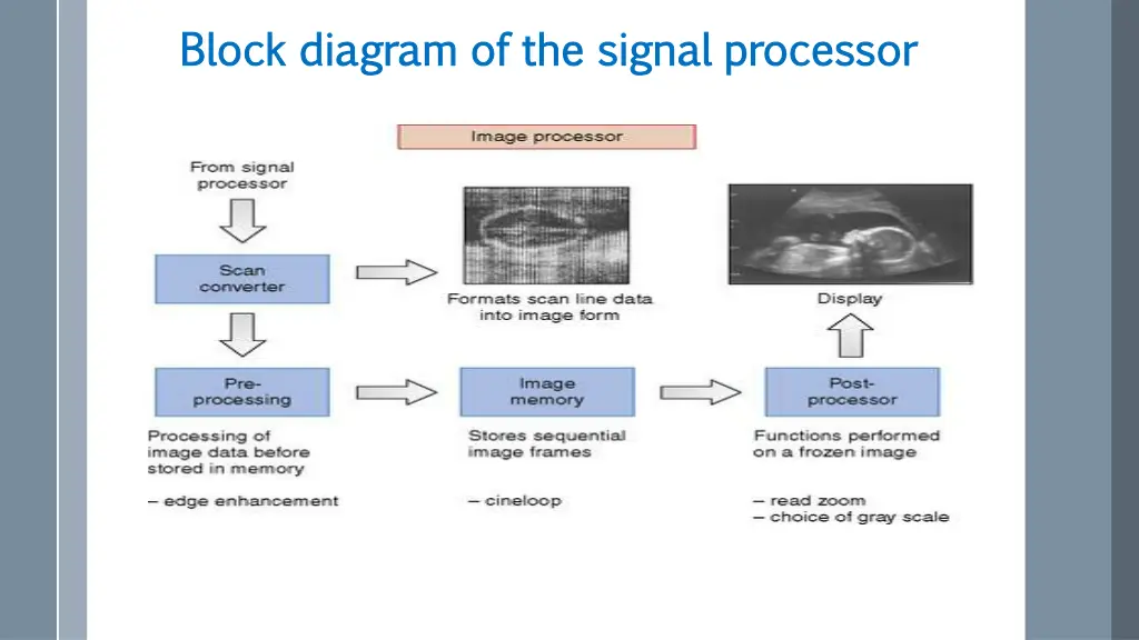 block diagram of the block diagram of the signal