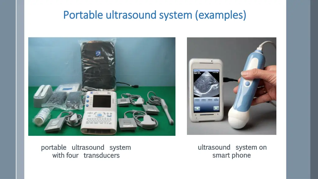 portable ultrasound system examples portable