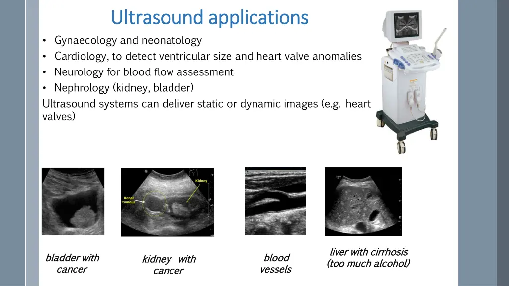 ultrasound applications ultrasound applications