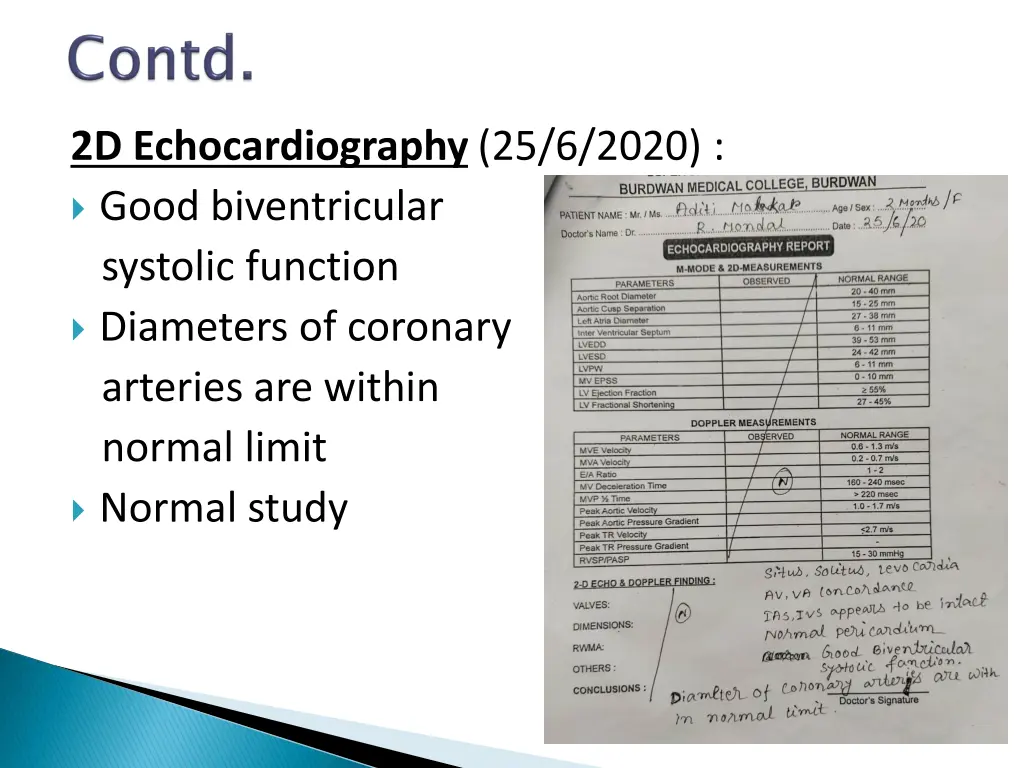 2d echocardiography 25 6 2020 good biventricular